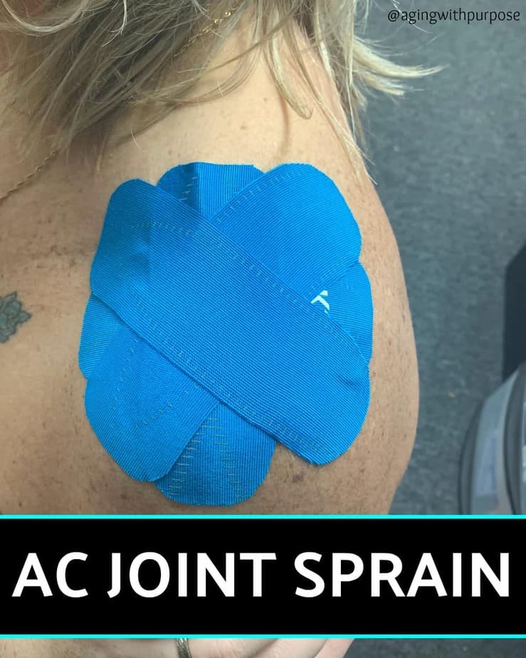 AC JOINT SPRAIN Buffalo Occupational Therapy Alternative Pain Managment - Buffalo Occupational Therapy