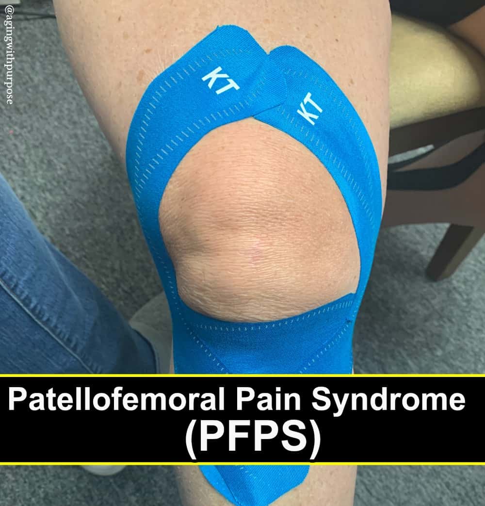 Patellofemoral Pain Syndrome PFPS- Buffalo Occupational Therapy Alternative Pain Management