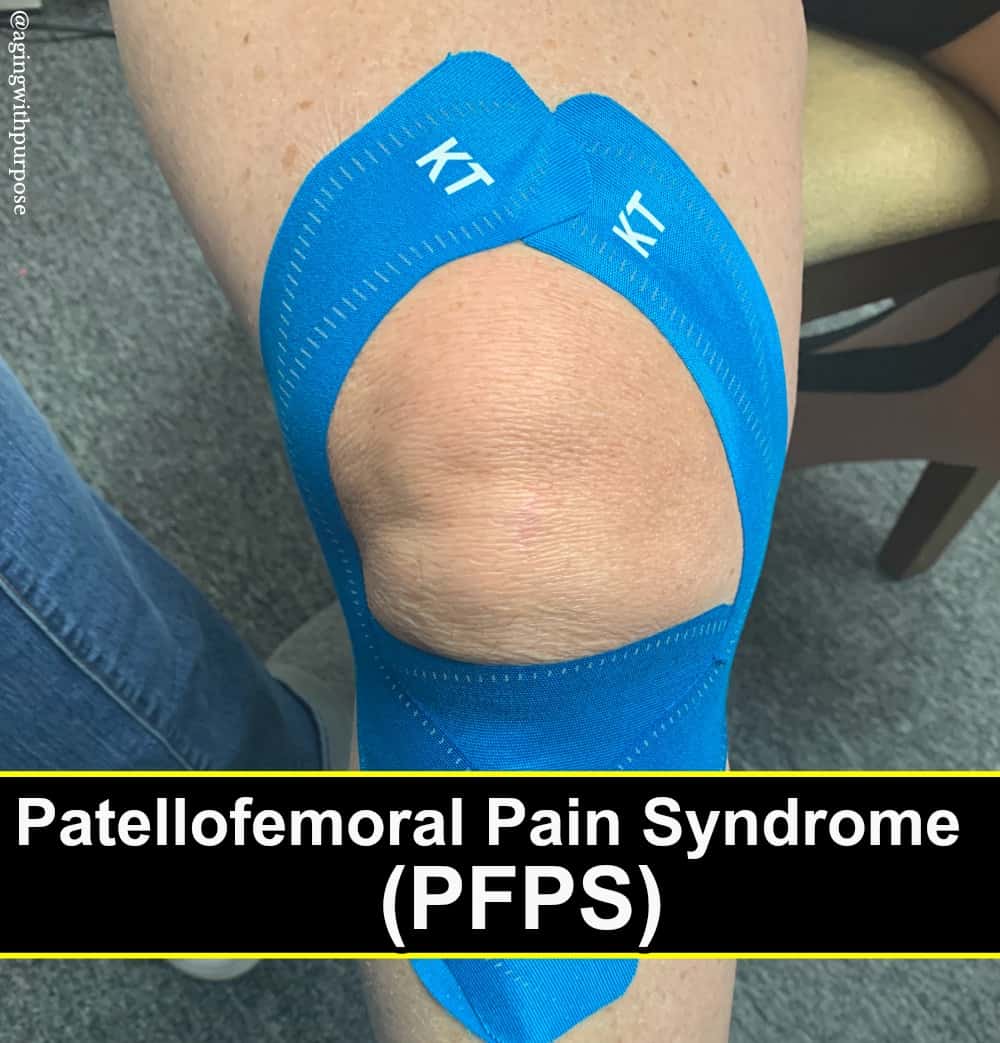 Patellofemoral Pain Syndrome PFPS Buffalo Occupational Therapy Alternative Pain Managment - Buffalo Occupational Therapy