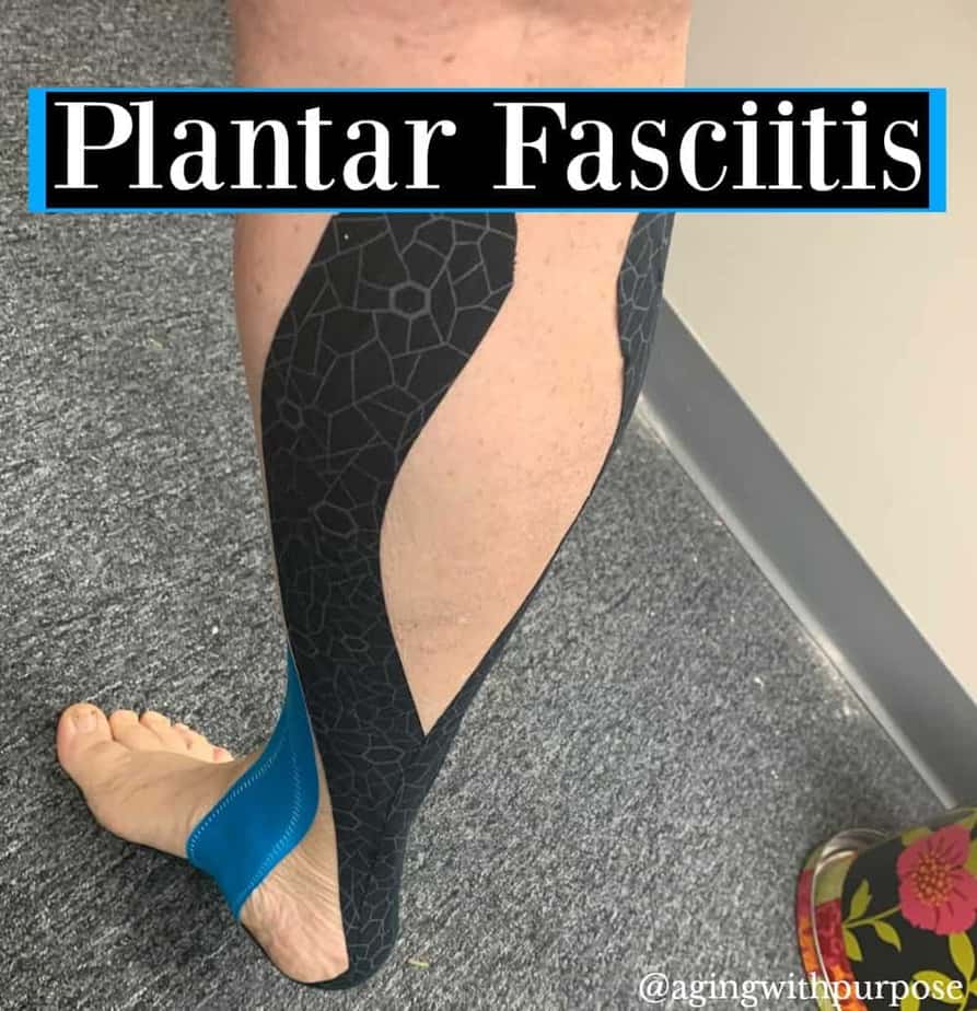 Plantar Fascitis-Buffalo Occupational Therapy Alternative Pain Managment