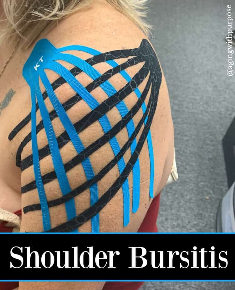 shoulder bursitis-Buffalo Occupational Therapy Alternative Pain Managment