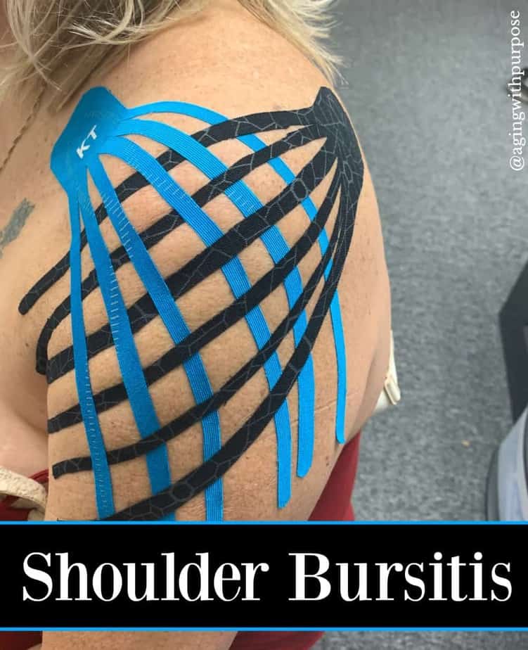shoulder bursitis Buffalo Occupational Therapy Alternative Pain Managment - Buffalo Occupational Therapy