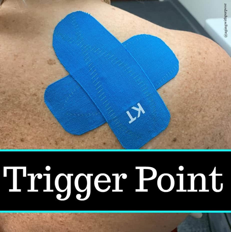trigger point Buffalo Occupational Therapy Alternative Pain Managment - Buffalo Occupational Therapy