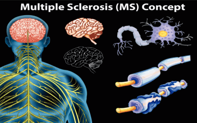 Multiple Sclerosis and Rehabilitation