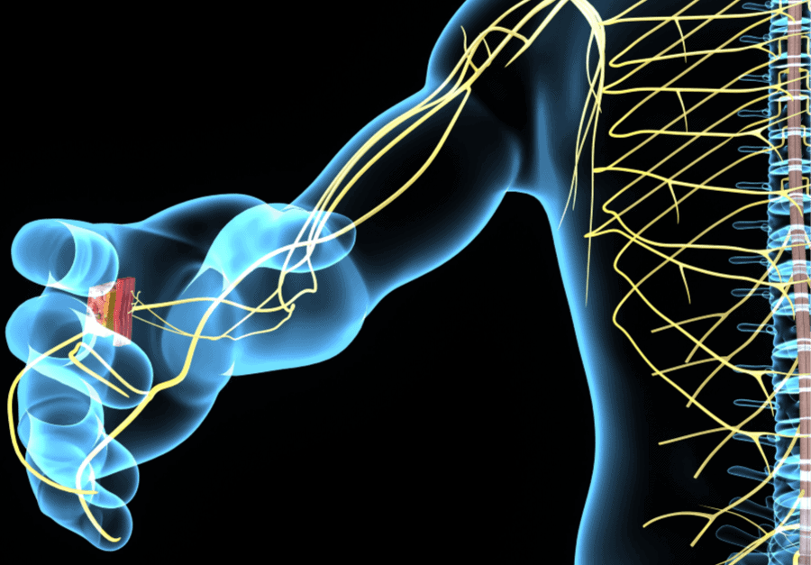 Parkinson's disease nerve synapses- Neurological Rehabilitation