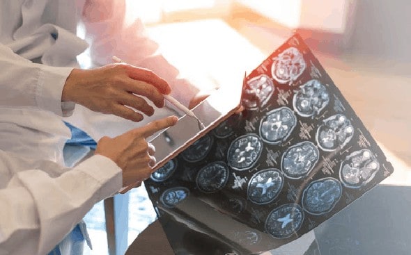 Outpatient Stroke Rehab in Buffalo NY - Buffalo Occupational Therapy Outpatient Stroke Rehab in Buffalo NY - Buffalo Occupational Therapy
