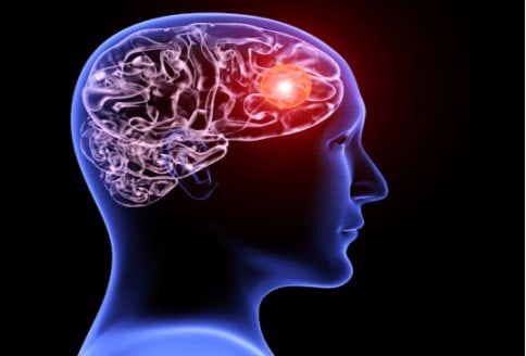 Progressive Neurological Disorders - Buffalo Occupational Therapy (1)