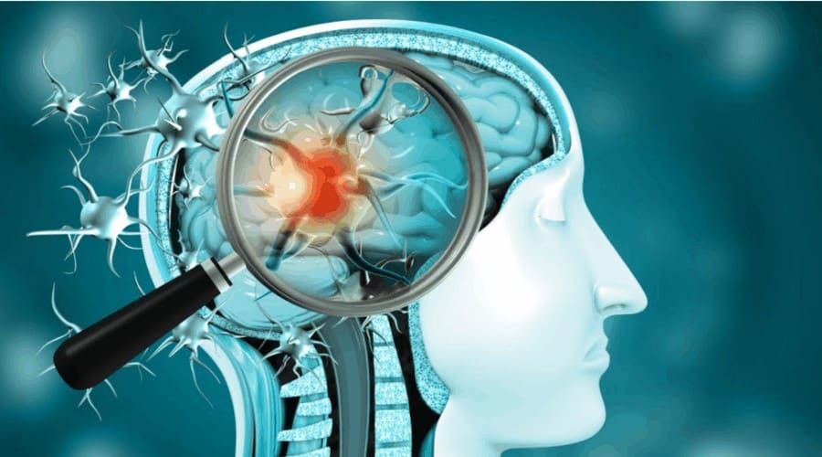 Progressive Neurological Disorders - Buffalo Occupational Therapy Progressive Neurological Disorders - Buffalo Occupational Therapy