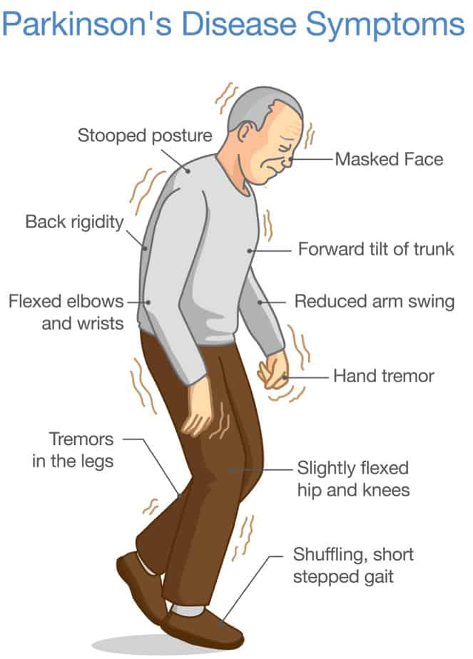 Parkinson's Disease Symptoms - Buffalo Occupational Therapy