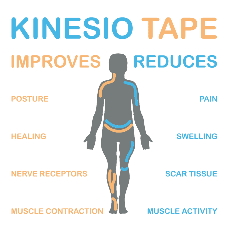 Kinesiology Tape for Dystonia and movement disorders