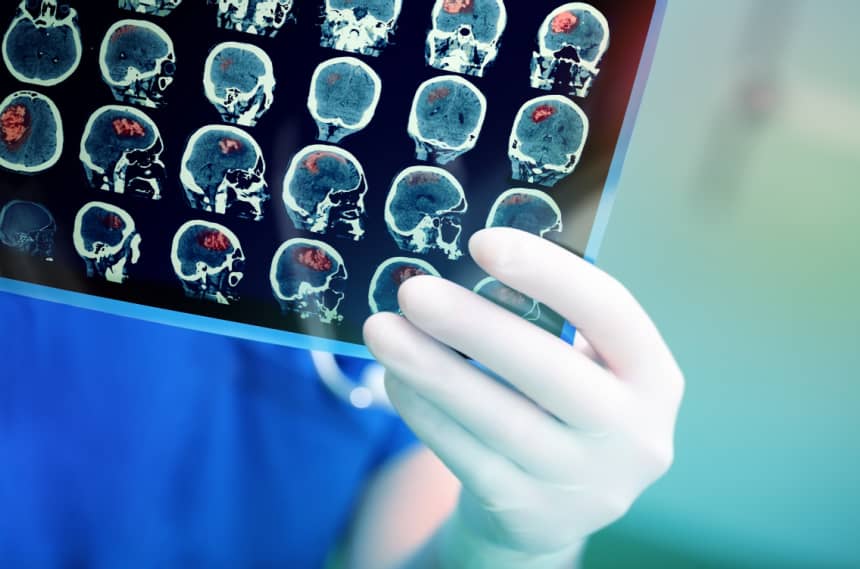 Doctor attentively examines the MRI scan of the patient. Website 1 - Buffalo Occupational Therapy